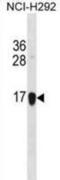 Histone H2B type 1-J antibody, abx031212, Abbexa, Western Blot image 