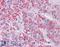 Metastasis Associated 1 antibody, 45-094, ProSci, Immunohistochemistry paraffin image 