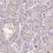 Zinc Finger Protein 304 antibody, HPA050531, Atlas Antibodies, Immunohistochemistry paraffin image 