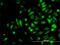 NME/NM23 Nucleoside Diphosphate Kinase 2 antibody, H00004831-M06, Novus Biologicals, Immunocytochemistry image 
