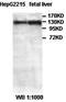 Zinc Finger And BTB Domain Containing 41 antibody, orb77478, Biorbyt, Western Blot image 