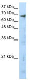 Histone acetyltransferase KAT5 antibody, TA343605, Origene, Western Blot image 
