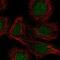 RAR-alpha antibody, NBP2-58082, Novus Biologicals, Immunofluorescence image 