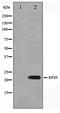 Ribosomal Protein S9 antibody, TA347574, Origene, Western Blot image 