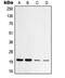 Translocase Of Outer Mitochondrial Membrane 20 antibody, MBS820677, MyBioSource, Western Blot image 