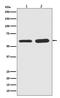 SMAD Family Member 5 antibody, P01423-1, Boster Biological Technology, Western Blot image 
