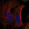 Farnesyltransferase, CAAX Box, Beta antibody, HPA062743, Atlas Antibodies, Immunofluorescence image 