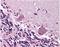 Cerebellar degeneration-related protein 2 antibody, NB110-58345, Novus Biologicals, Immunohistochemistry frozen image 