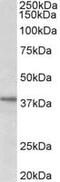 Uncharacterized protein C12orf29 antibody, MBS423062, MyBioSource, Western Blot image 