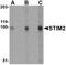 Stromal interaction molecule 2 antibody, NBP1-76791, Novus Biologicals, Western Blot image 