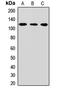 Cleavage and polyadenylation specificity factor subunit 2 antibody, LS-C668564, Lifespan Biosciences, Western Blot image 