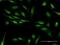Zinc Finger CCHC-Type And RNA Binding Motif Containing 1 antibody, H00085437-B01P, Novus Biologicals, Immunofluorescence image 