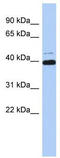 Myc-associated zinc finger protein antibody, TA334773, Origene, Western Blot image 