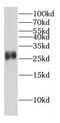 Density Regulated Re-Initiation And Release Factor antibody, FNab02334, FineTest, Western Blot image 
