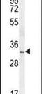 NK2 Homeobox 1 antibody, PA5-25940, Invitrogen Antibodies, Western Blot image 