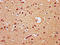 Transcription Factor 20 antibody, LS-C681523, Lifespan Biosciences, Immunohistochemistry paraffin image 