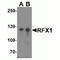MHC class II regulatory factor RFX1 antibody, TA349180, Origene, Western Blot image 