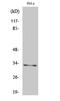 Mitochondrial Ribosomal Protein L15 antibody, A14077-1, Boster Biological Technology, Western Blot image 