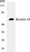 Keratin 10 antibody, EKC1320, Boster Biological Technology, Western Blot image 