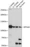 EPH Receptor A5 antibody, GTX66237, GeneTex, Western Blot image 