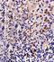Cytokeratin Pan  antibody, orb10399, Biorbyt, Immunohistochemistry paraffin image 