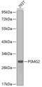 Proteasome Assembly Chaperone 2 antibody, 13-244, ProSci, Western Blot image 