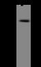 Ubiquitin carboxyl-terminal hydrolase 8 antibody, 200213-T44, Sino Biological, Western Blot image 