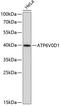 ATPase H+ Transporting V0 Subunit D1 antibody, GTX66439, GeneTex, Western Blot image 