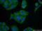 Clathrin Heavy Chain antibody, 26523-1-AP, Proteintech Group, Immunofluorescence image 