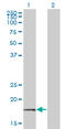 Basic Transcription Factor 3 antibody, LS-C196777, Lifespan Biosciences, Western Blot image 