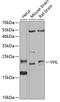 Von Hippel-Lindau Tumor Suppressor antibody, 13-158, ProSci, Western Blot image 