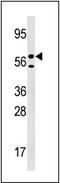 Uridine-Cytidine Kinase 1 Like 1 antibody, AP13862PU-N, Origene, Western Blot image 