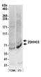 Zinc Finger DHHC-Type Containing 5 antibody, A304-652A, Bethyl Labs, Western Blot image 