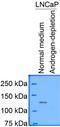 Histone deacetylase 5 antibody, TA336929, Origene, Western Blot image 
