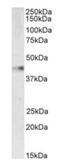Vasodilator Stimulated Phosphoprotein antibody, orb233650, Biorbyt, Western Blot image 