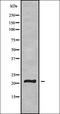 Transmembrane Protein 37 antibody, orb336197, Biorbyt, Western Blot image 