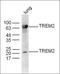 Protein Tyrosine Kinase 2 antibody, orb69553, Biorbyt, Western Blot image 