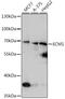 Extracellular Matrix Protein 1 antibody, A02861, Boster Biological Technology, Western Blot image 