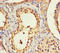 Biogenesis Of Lysosomal Organelles Complex 1 Subunit 1 antibody, A53861-100, Epigentek, Immunohistochemistry paraffin image 