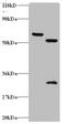 Zinc Finger Protein 384 antibody, A53949-100, Epigentek, Western Blot image 