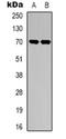 Sphingosine kinase 2 antibody, orb318871, Biorbyt, Western Blot image 