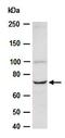 High affinity choline transporter 1 antibody, orb67028, Biorbyt, Western Blot image 