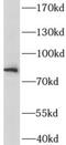 gp80 antibody, FNab04284, FineTest, Western Blot image 
