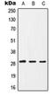 CD40 Ligand antibody, orb213693, Biorbyt, Western Blot image 