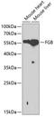 Fibrinogen Beta Chain antibody, GTX54019, GeneTex, Western Blot image 