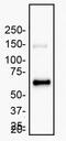 Matrix Metallopeptidase 2 antibody, GTX27033, GeneTex, Western Blot image 