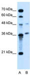 Armadillo Repeat Containing X-Linked 6 antibody, TA335507, Origene, Western Blot image 