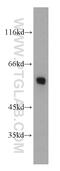 Fibrinogen Beta Chain antibody, 16747-1-AP, Proteintech Group, Western Blot image 