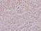 LYN Proto-Oncogene, Src Family Tyrosine Kinase antibody, A01424T501, Boster Biological Technology, Immunohistochemistry paraffin image 