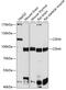 Cadherin-4 antibody, GTX64857, GeneTex, Western Blot image 